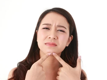 Cara Mengatasi Jerawat dengan Minum Air Putih, Simak!