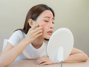 8 Ciri-ciri Kulit Sensitif, Ini Penyebab & Cara Merawatnya