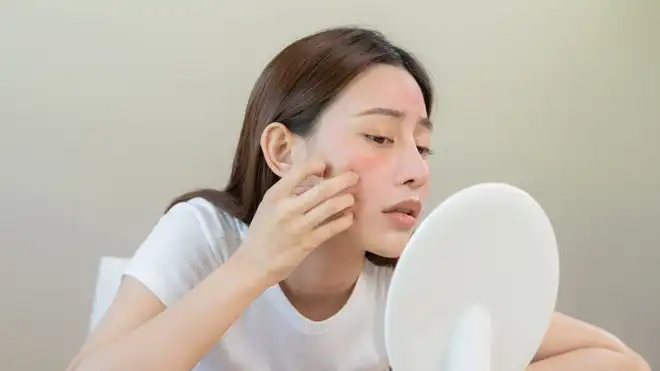 8 Ciri-ciri Kulit Sensitif, Ini Penyebab & Cara Merawatnya