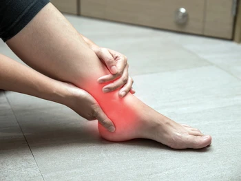 Cedera Engkel: Ciri-Ciri, Penyebab, dan Cara Mengatasinya